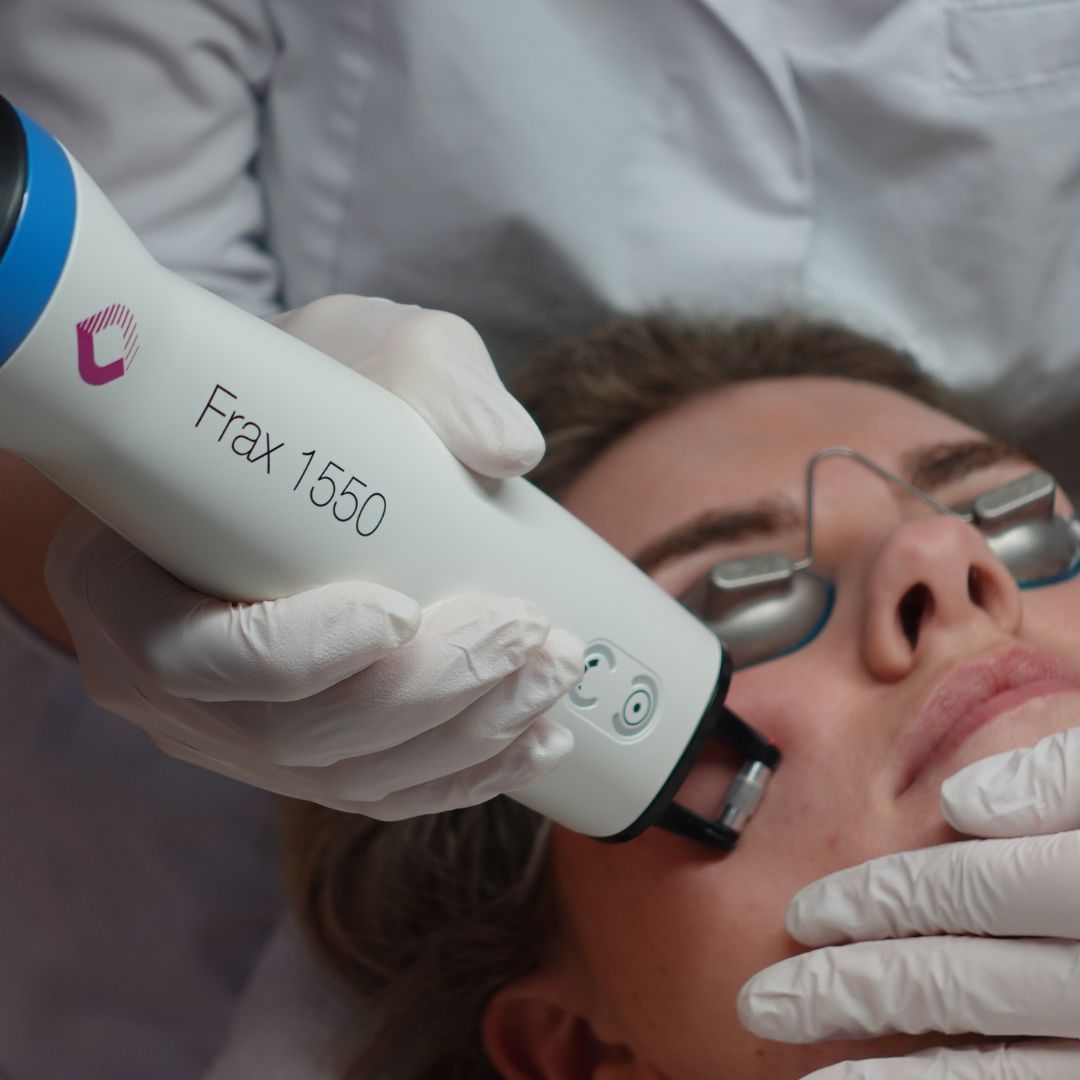 Fractionele Laser